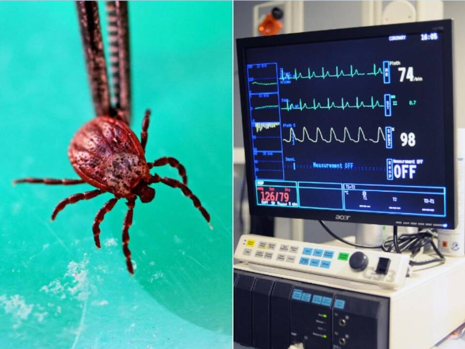 Antroji šiemet erkinio encefalito auka – sostinėje