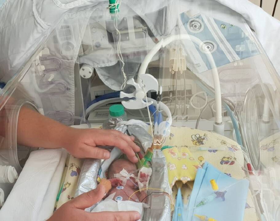 Mažiausia naujagimė šalyje Skaistė: kaip jai sekasi šiandien?