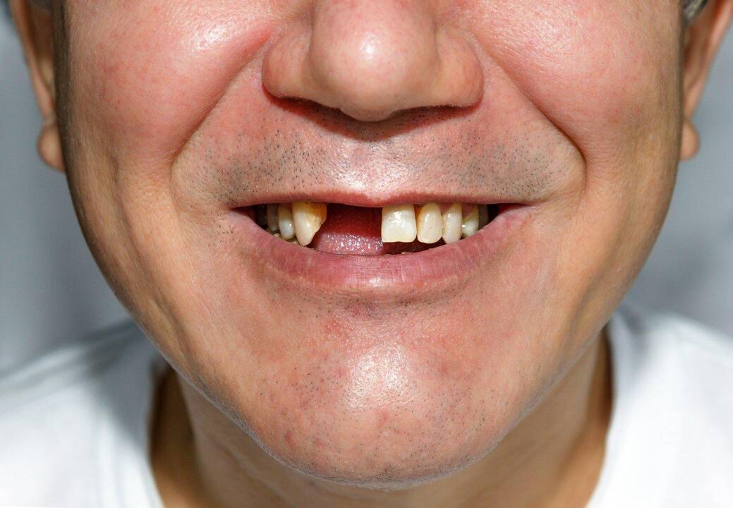 Asociatyvi nuotr.