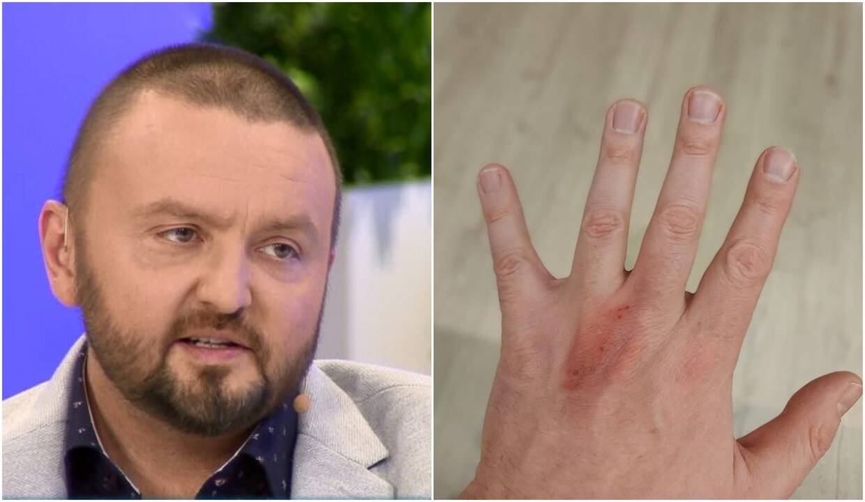 Atlikėją Stano sužalojo fejerverkas: sprogimo būta tokio garsaus, kad apkurtau