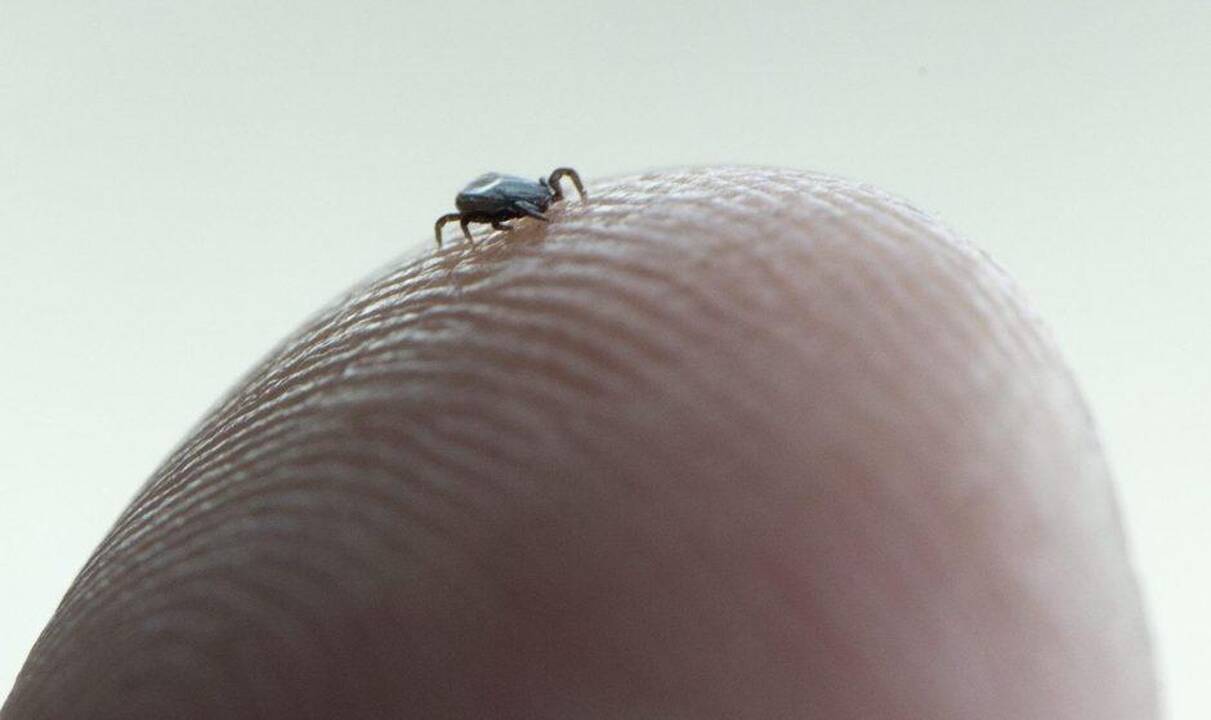 Kaune nuo erkinio encefalito mirė moteris