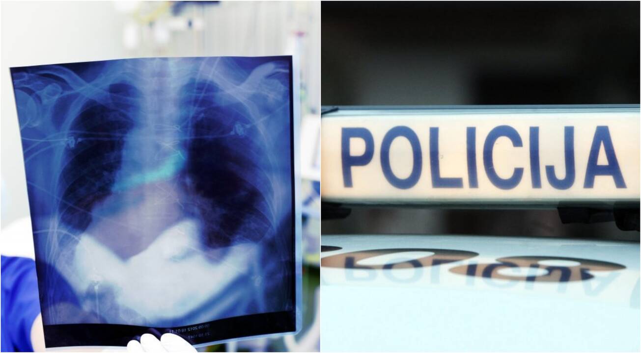 Iš Santaros klinikų pasišalinęs tuberkulioze sergantis vyras lauks teismo
