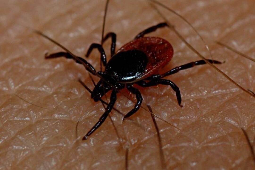 Už erkės įkandimą buvusiai moksleivei - 41,7 milijono JAV dolerių