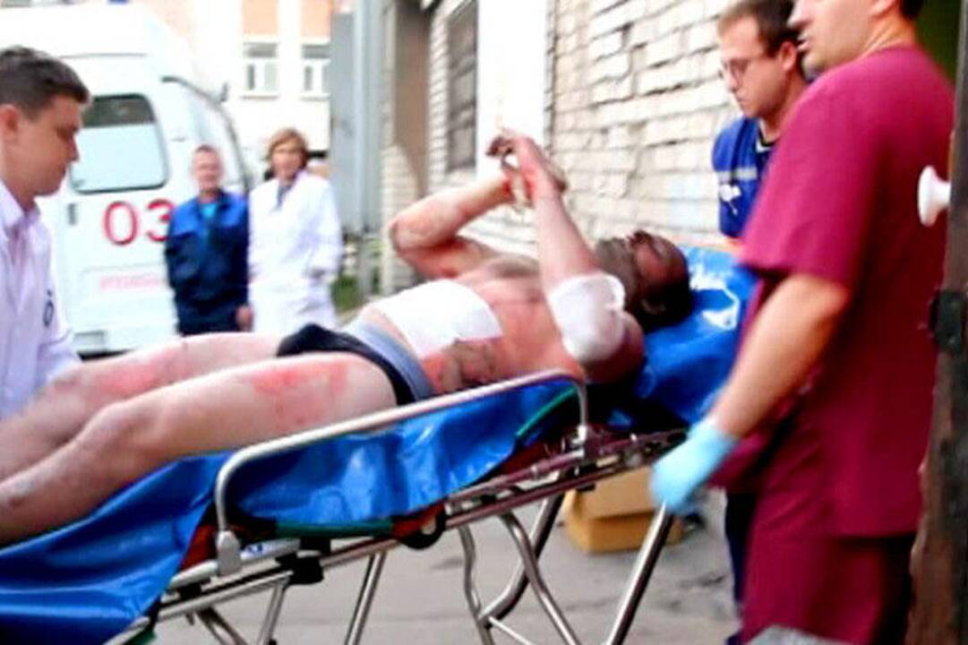Per lėktuvo katastrofą likusio gyvo Galimovo būklė nepasikeitė