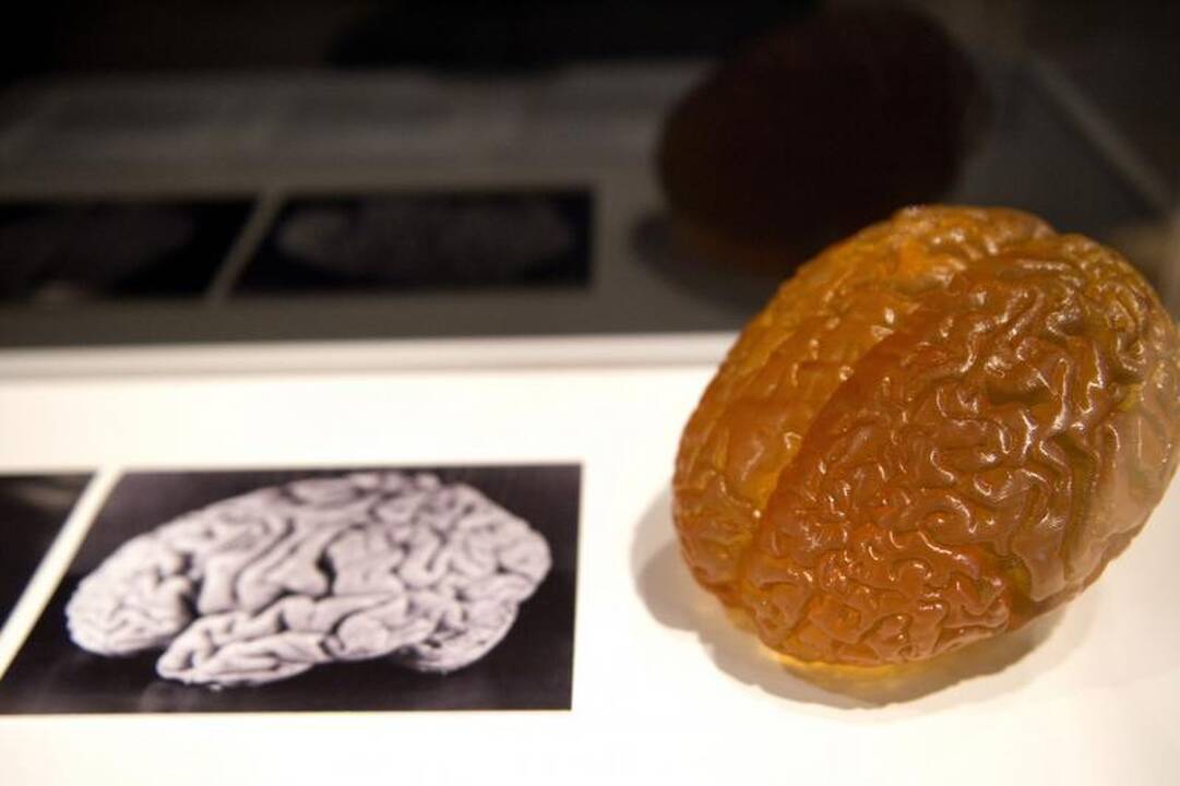 Patikimiausias būdas intelektui išmatuoti – smegenų skenavimas?