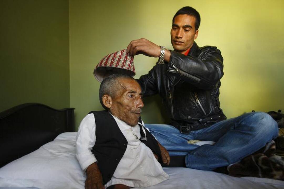 72 metų Nepalo gyventojas pripažintas mažiausiu pasaulyje vyru