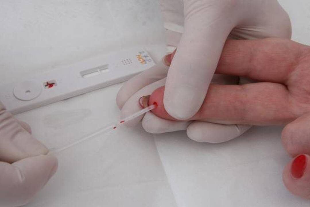 Klaipėdiečiai nemokamai tikrinami dėl hepatito