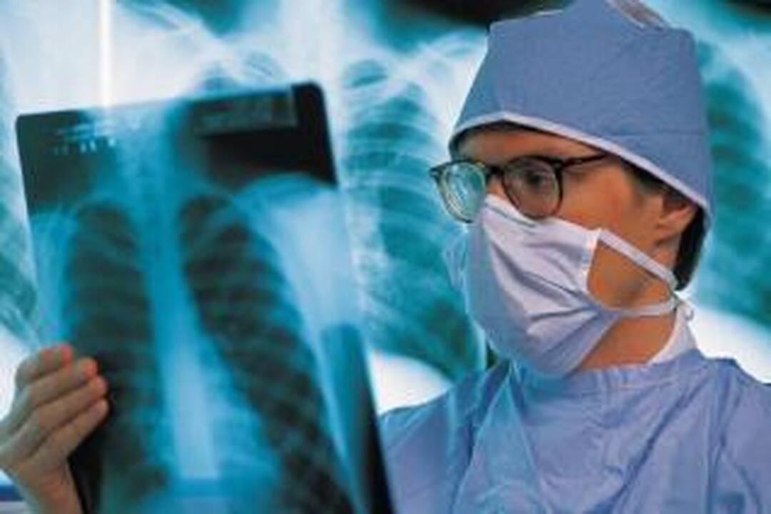 Tuberkuliozė Klaipėdos apskrityje toliau grėsmingai plinta