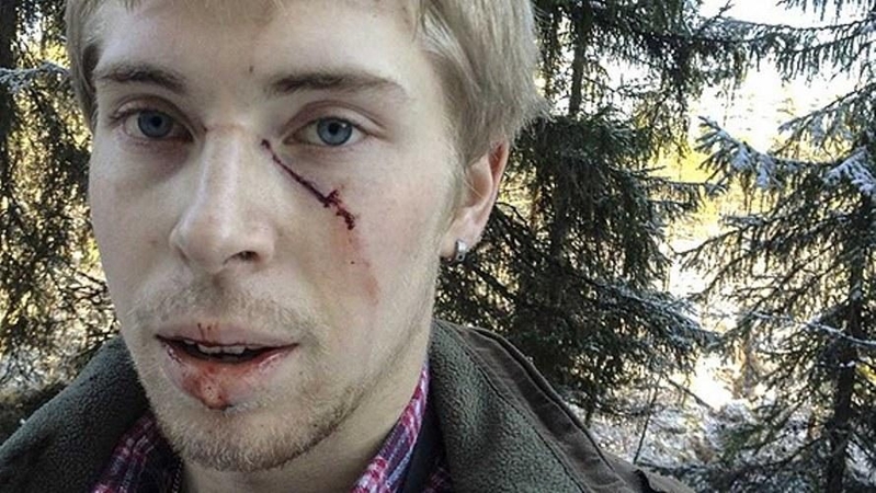 Lokės užkluptas ledo ritulininkas: gulėjau ant žemės, o ji ant manęs