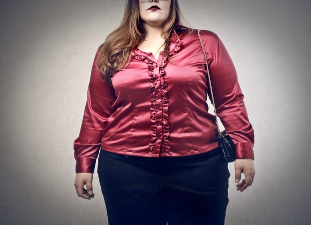 Daugiau nei 170 kg. svėrusi moteris: svoris „užaugo“ nuo rūpesčių