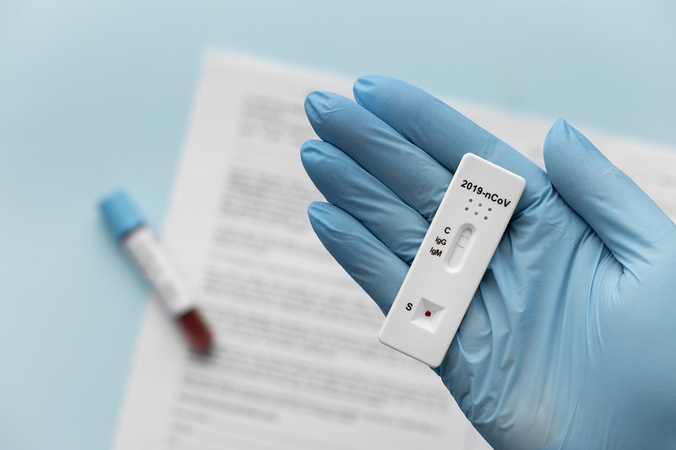 COVID-19 statistika: per parą užfiksuoti 469 nauji atvejai, mirusių nėra
