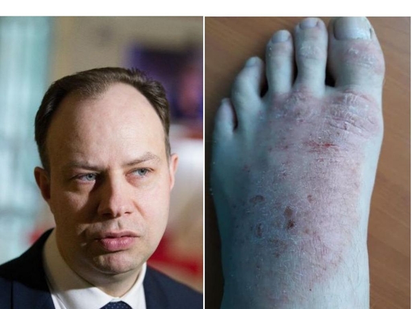 Nuo žaizdų kenčiantis vyras negali įsigyti vaistų ir keikia A. Verygą