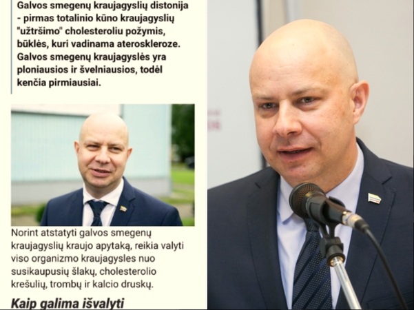 A. Veryga įspėja: jei vartosite kažką neaiškaus, prarasit ne tik pinigus, bet ir smegenis