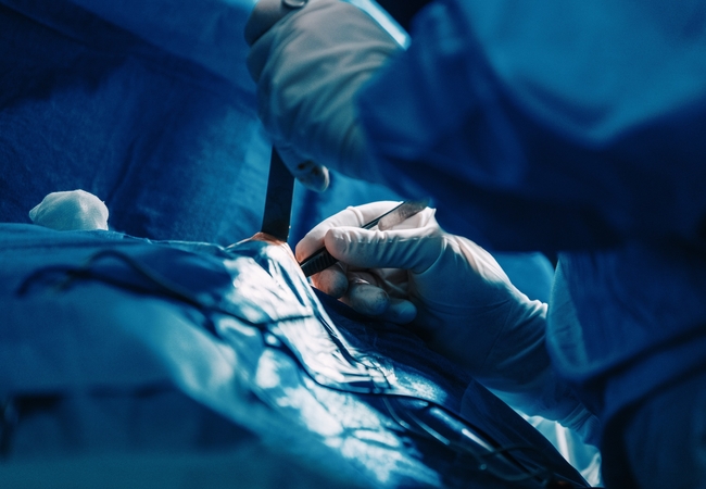 Pasirinkimas: krūties rekonstrukcijos būdų yra ne vienas – galima krūtį ar prarastą jos dalį atkurti savaisiais audiniais arba panaudojant individualiai parinktą implantą.