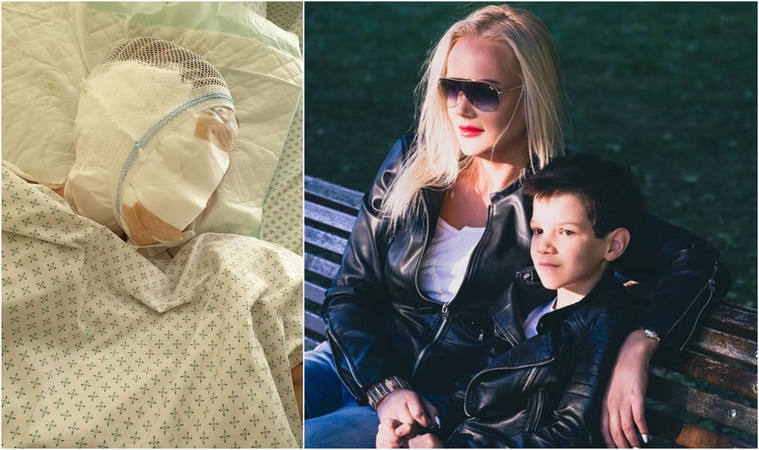 Žiauriai sukandžioto berniuko mama: ant rankų laikiau savo vaiką be pusės veido 