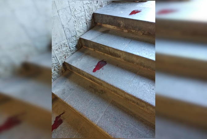 Taikos prospekte – sūnaus ir mamos tragedija: po sužalojimų vyras mirė ligoninėje
