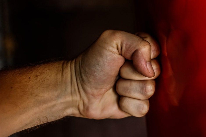 Konfliktas Lazdijuose: neblaivus vyras prakirto sugyventinei galvą