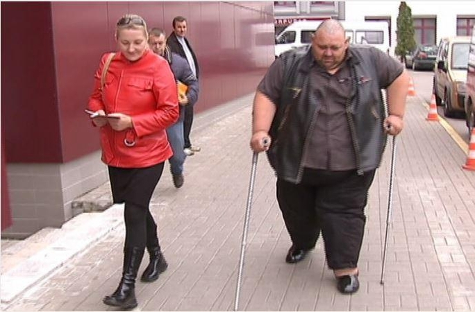 200 kg ir 301 kg: apkunių žmonių problemos ir patyčios