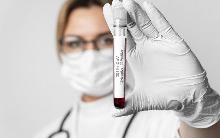Iš ligoninės pabėgusią virusu užsikrėtusią moterį siūloma bausti viešais darbais