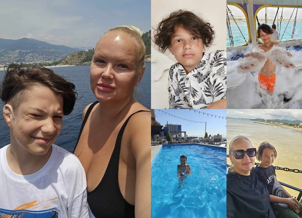 Šuns sukandžioto berniuko mama: matydama iš gabalų surinktą sūnų, išmokau pamoką