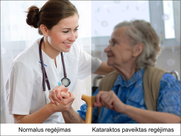 Sergant katarakta delsti negalima