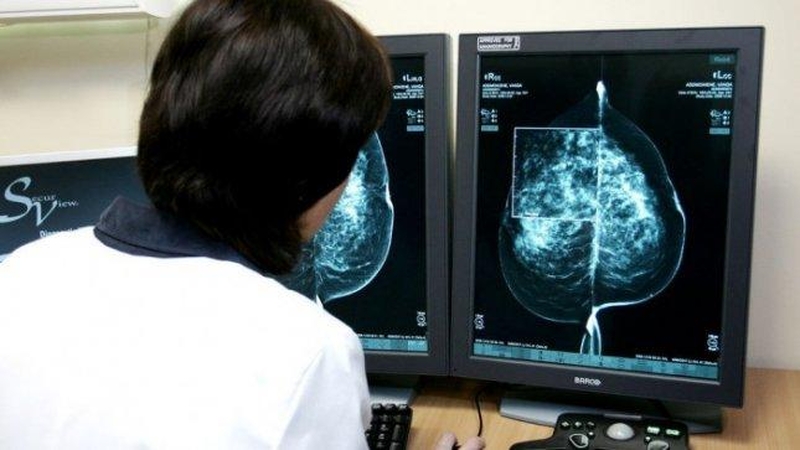 Onkologinių ligonių skaičius auga: serga apie 3 proc. Lietuvos gyventojų