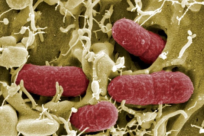 Į Lietuvą įvežta E. coli galėjusių sukelti sėklų