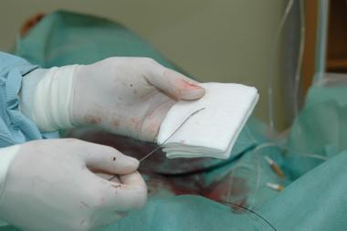 Klinikose atlikta nauja operacija