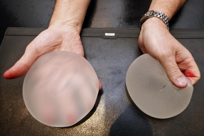 Krūtų implantus gali tekti pašalinti ir 40 tūkst. bričių