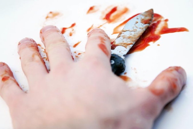 Sumuštas ir perdurtas klaipėdietis pateko į ligoninę