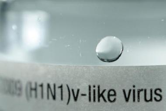 Užkratas: virusas A(H1N1), pasak gydytojų, primena ispaniškojo gripo virusą.