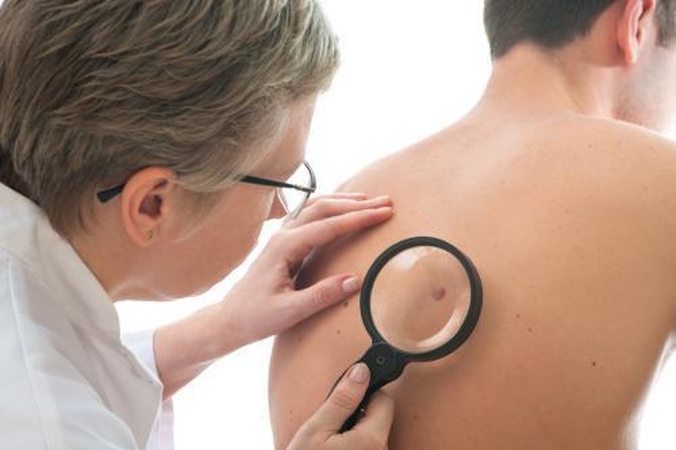 Melanoma aktuali ir jauniems
