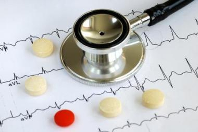 Infarktas: vainikinių arterijų zondavimo ir plėtimo procedūros atliekamos tik penkiuose didžiuosiuose šalies miestuose esančiose ligoninėse.